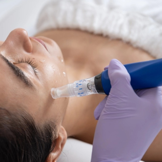 Skin Pen Micro-needling 3 sessions